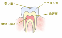 C0 【ごく初期の虫歯】