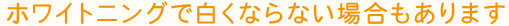 ホワイトニングで白くならない場合もあります